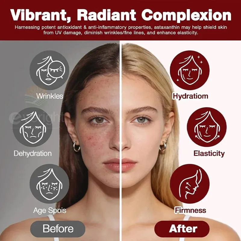 Astaxanthin 24mg – Powerful Antioxidant for Skin Eyes Immune System – 10-in-1 Formula Lycopene Grape Seed Vitamin E & Zinc — image 2