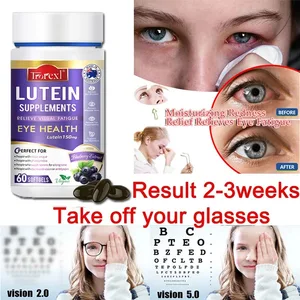 Trorexl Restore Vision Luteiiniuutelisä silmien rasitukseen Lievittää silmien väsymystä punaisten ja kuivien silmien